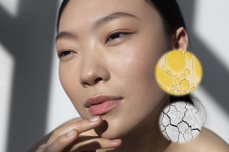 Oily vs Dehydrated Skin: How to Identify Your Skin Type?